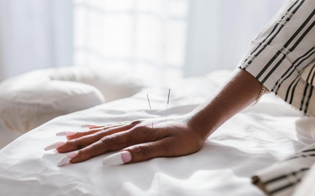 How Can Acupuncture Help With Fertility?
